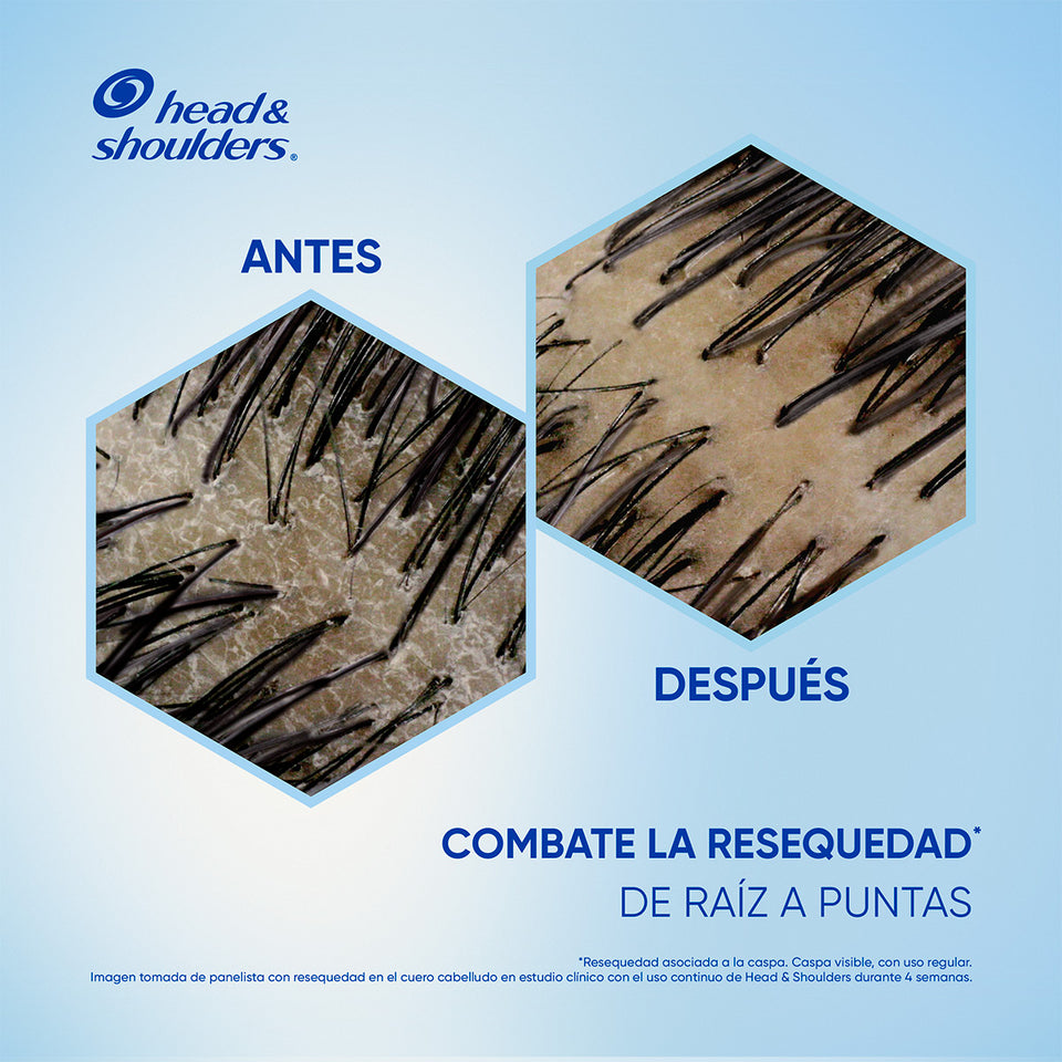 Head & Shoulders ha desarrollado la fórmula más nutritiva de su portafolio que nutre, retiene la hidratación y elimina la caspa del cuero cabelludo seco.