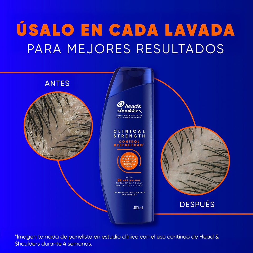 Imágenes de antes y después de cuero cabelludo junto a botella de Head & Shoulders Clinical Strength sobre fondo azul, con texto "Úsalo en Cada Lavada Para Mejores Resultados"