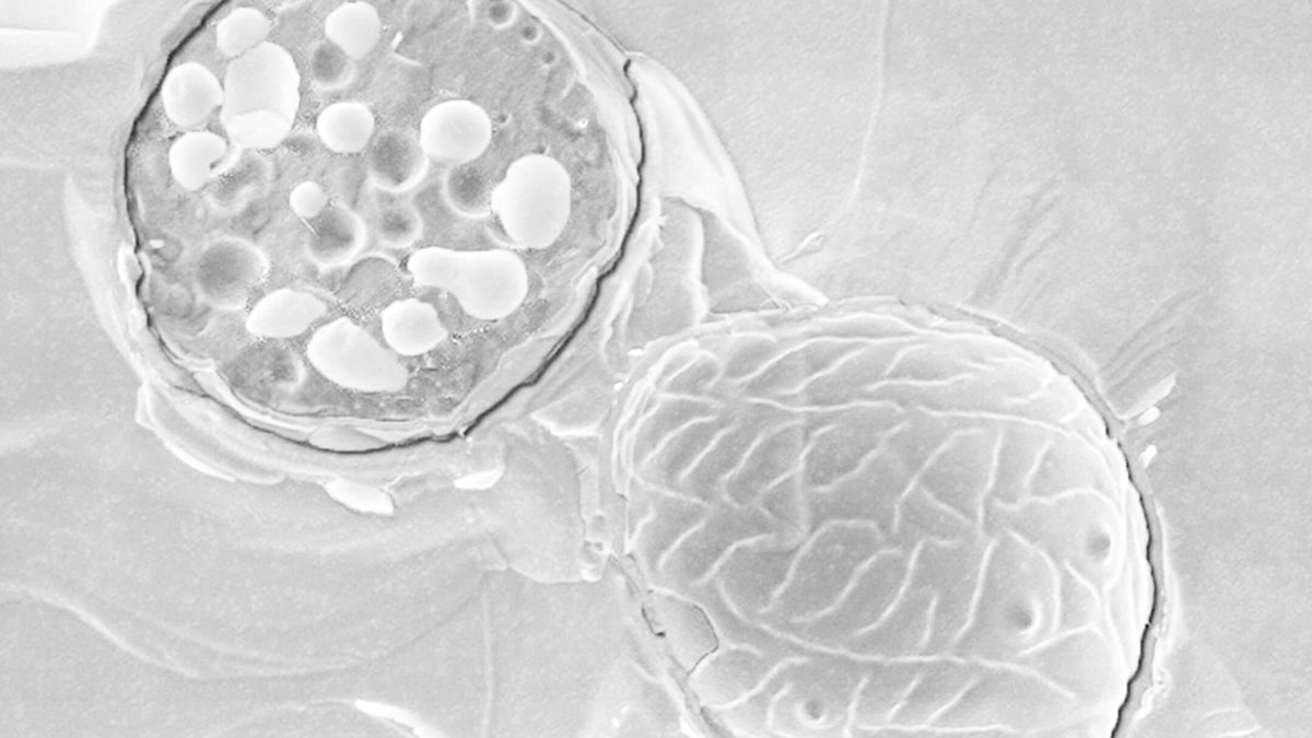 Investigación científica sobre el hongo Malassezia globosa, causante de la caspa